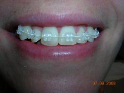 Foto de Debora Scarpa Odontologia por Dra Débora Scarpa Mend... em 15/12/2008
